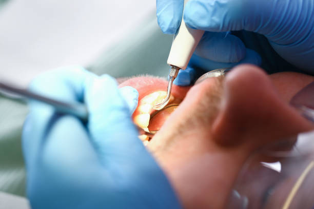 Best Emergency Broken Tooth Repair in Branson, MO
